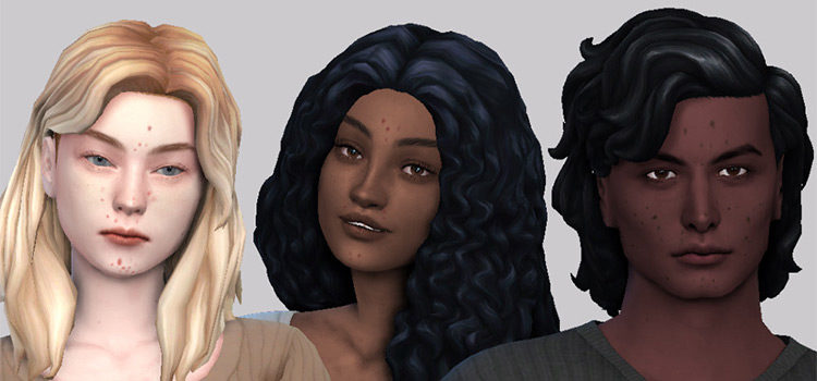 Best Sims 4 Acne Skin CC Details (All Free)