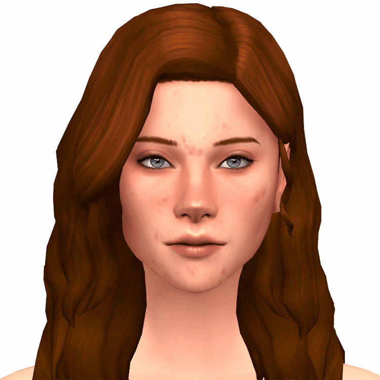 Best Sims 4 Acne Skin CC Details  All Free    FandomSpot - 68
