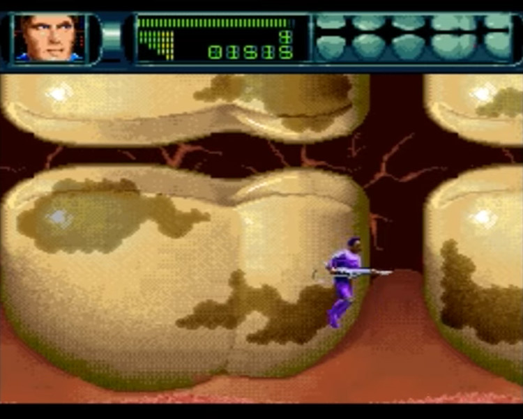 Rex Ronan: Experimental Surgeon SNES gameplay