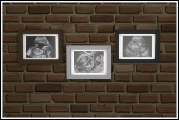 Ultrasound Scan by littlemssam Sims 4 CC