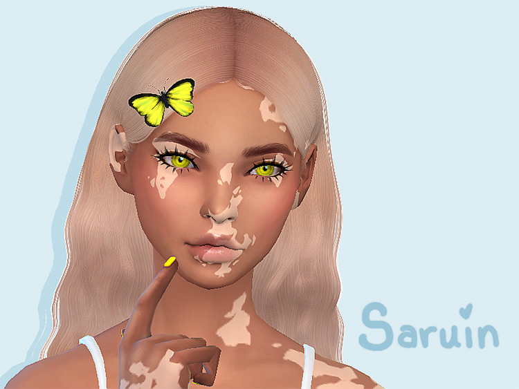 Skin Detail Vitiligo / Sims 4 CC